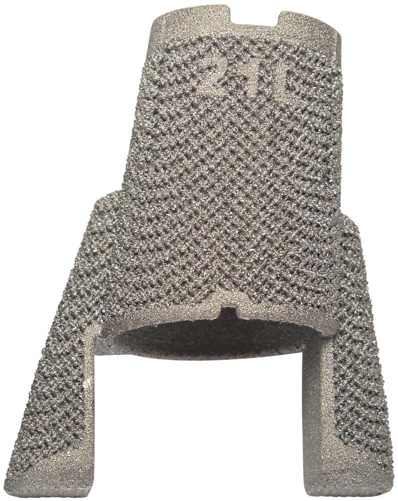 Image for AMF TT Cones - BICONDYLAR - FEMUR - L